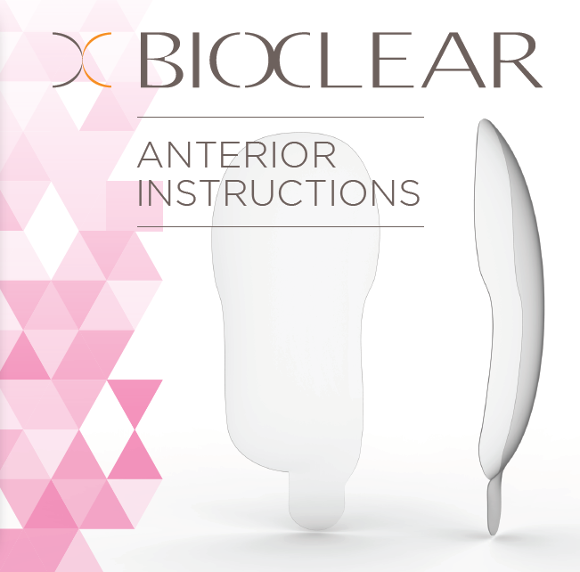 ANTERIOR MATRIX INSTRUCTIONS